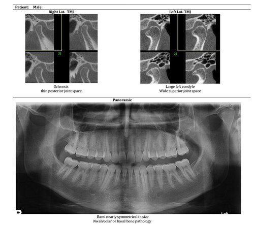 beam readers digital radiology dentist