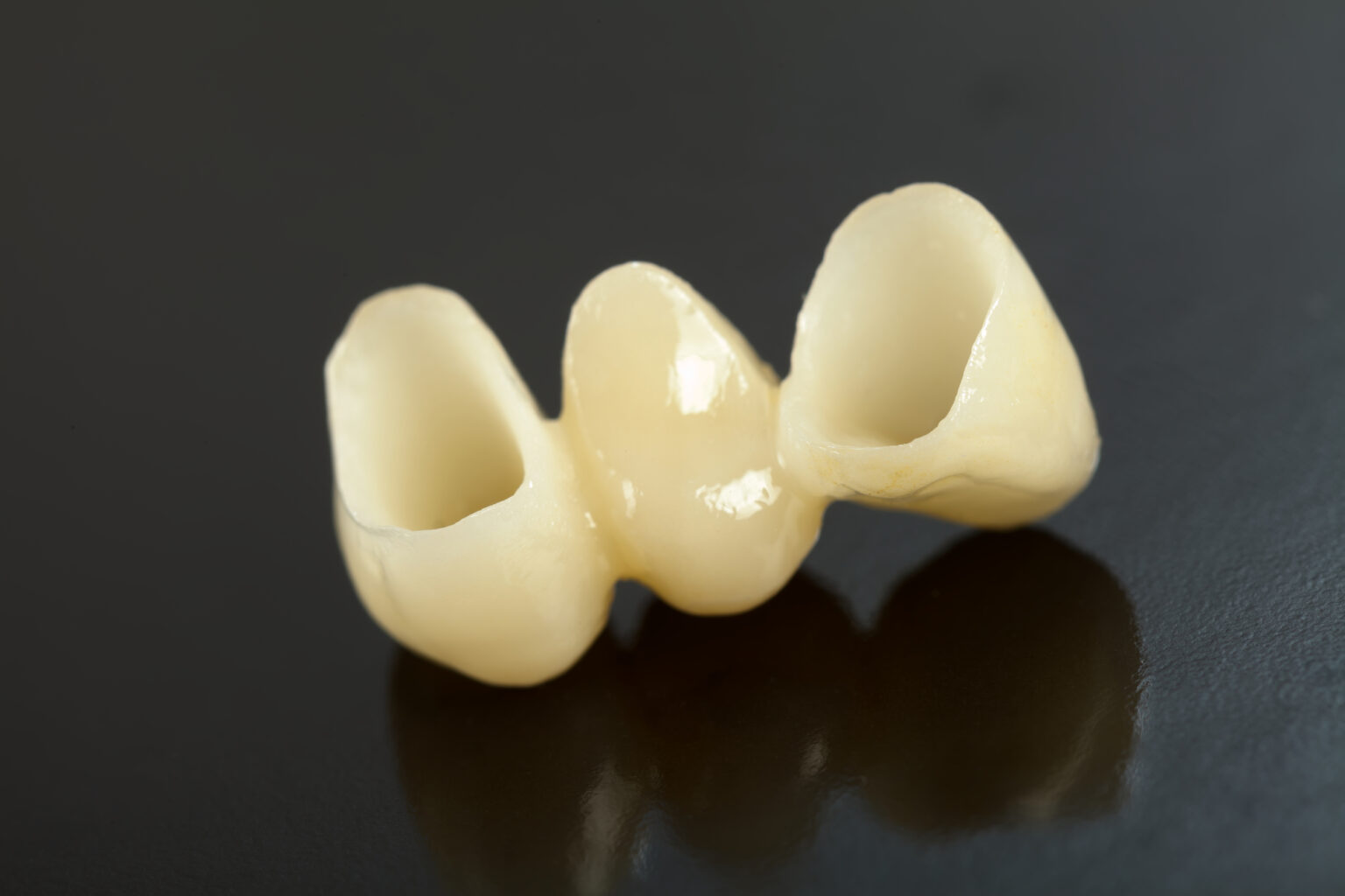 dental-bridges-a-bridge-is-one-of-the-few-options-to-replace-lost-teeth