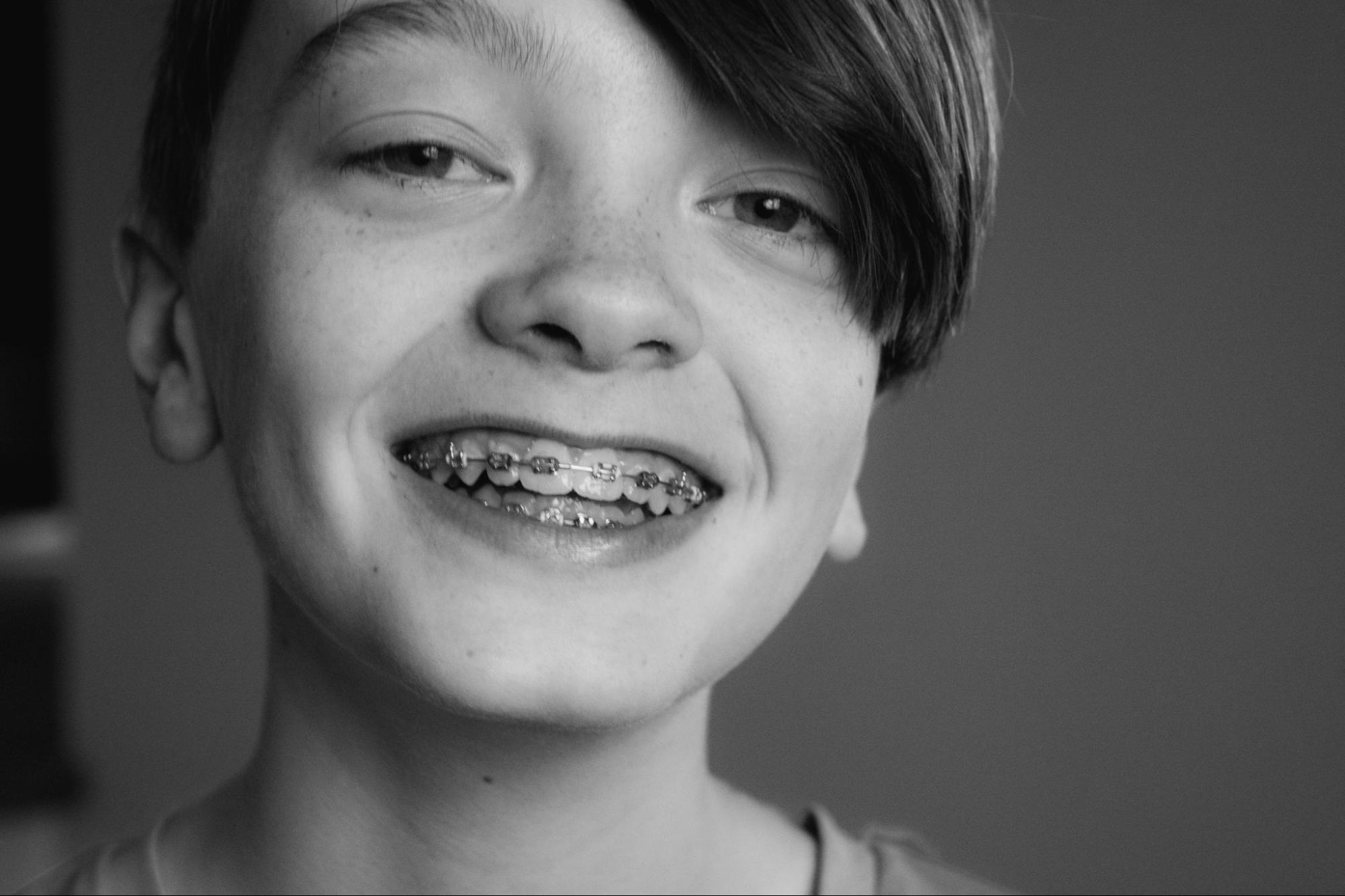 A child smiles widely with dental braces in Sacramento, CA