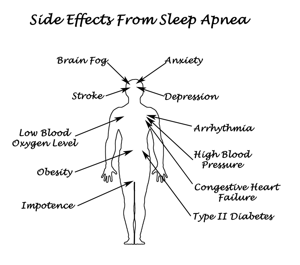 snoring and sleep apnea effects